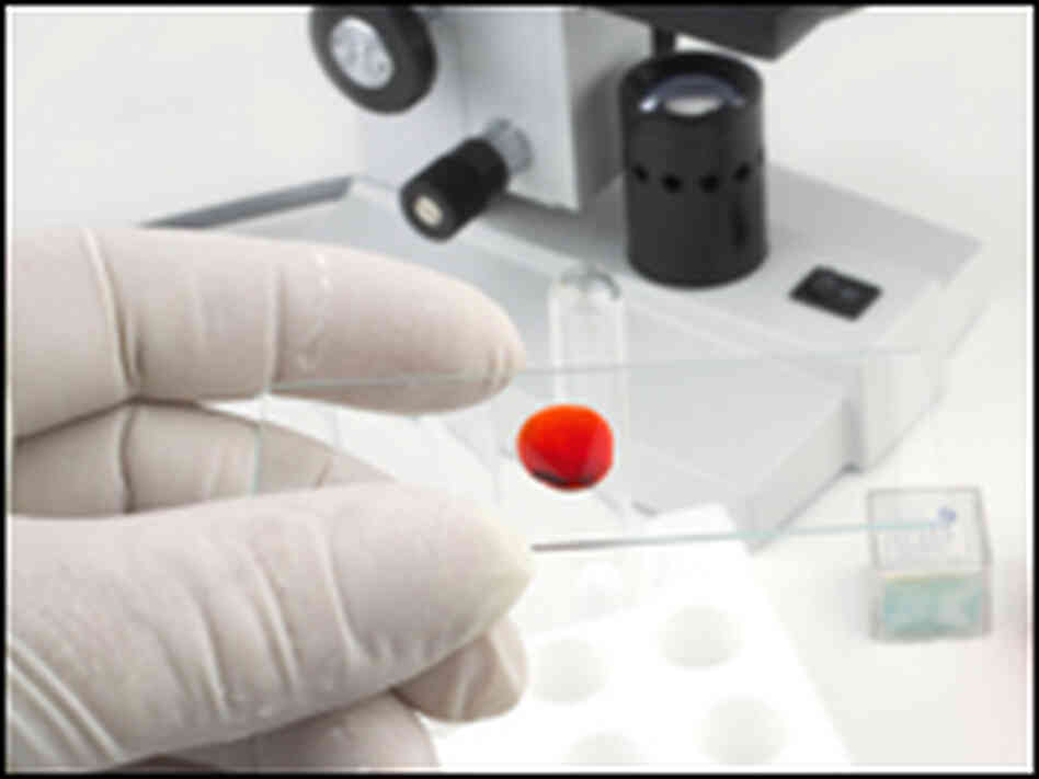 blood test blood test