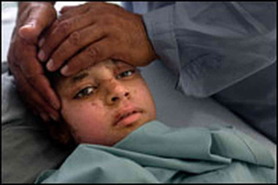 Tallah, 12, is soothed by her father Saeed Barakat in the burn unit in Herat, Afghanistan