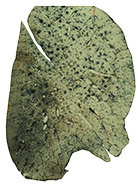 Photo of a lung in the early stages of 'black lung'