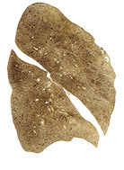 Photo of a healthy lung