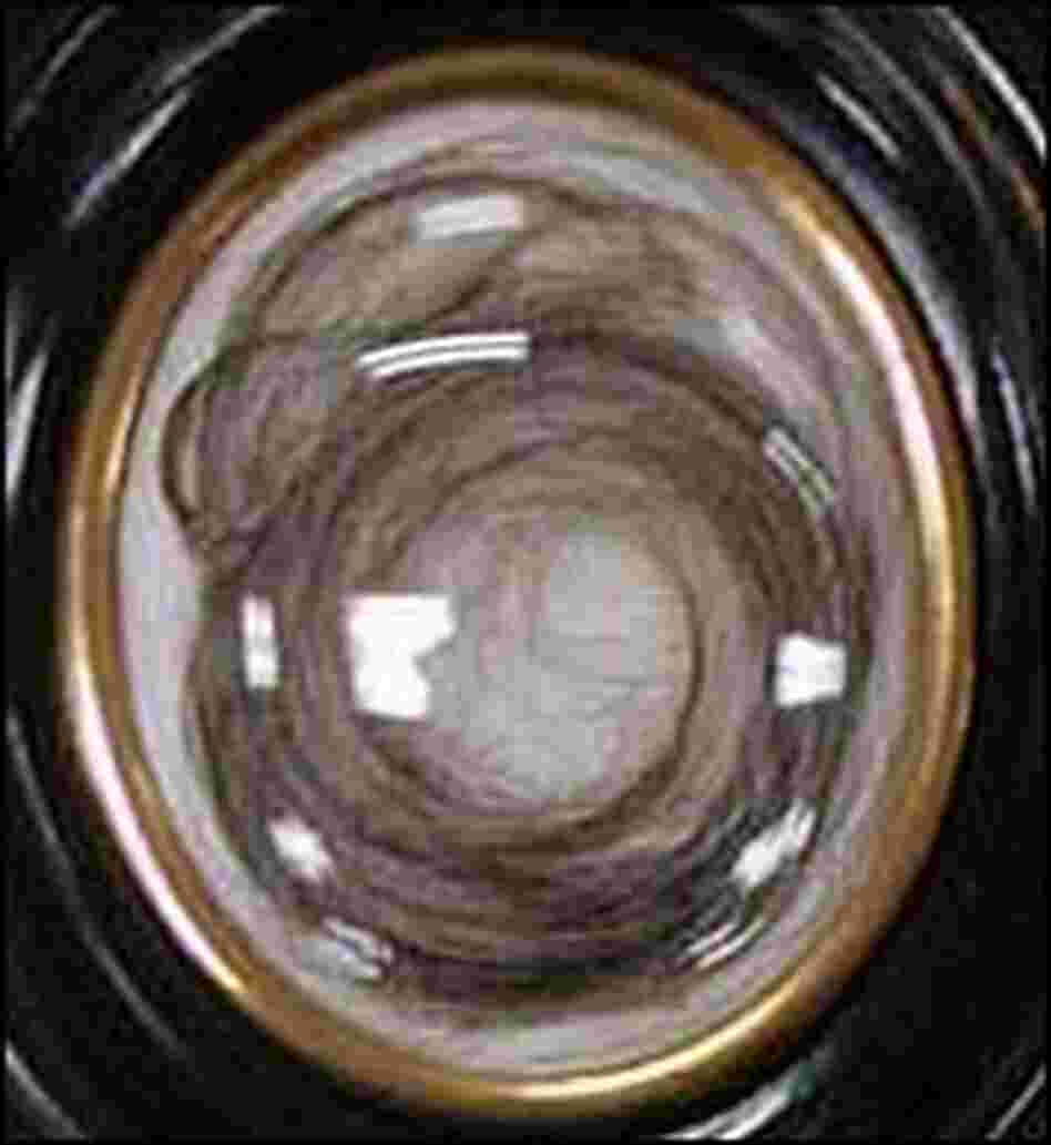 A sample of Beethoven's hair A sample of Beethoven's hair