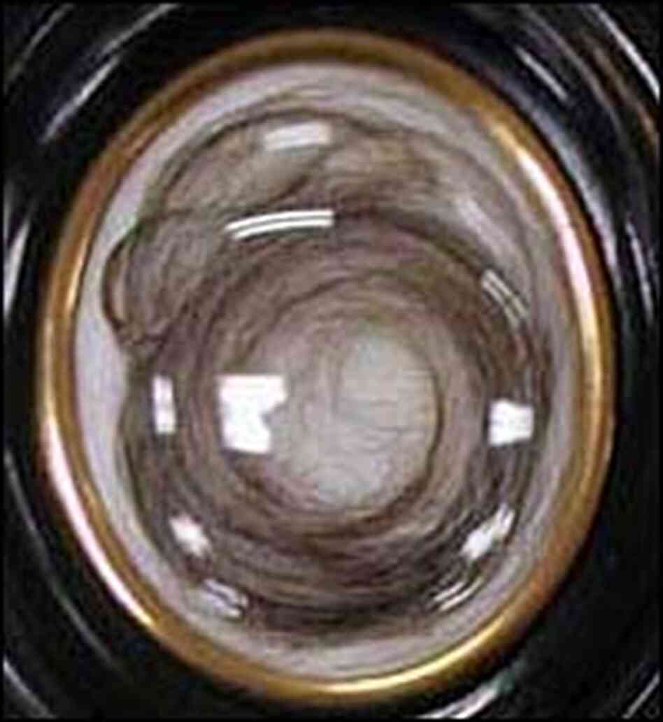A sample of Beethoven's hair A sample of Beethoven's hair