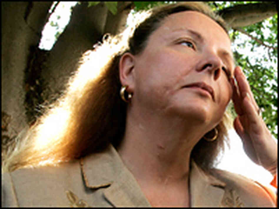 Abortion clinic bombing survivor Emily Lyons spoke to the media. Abortion clinic bombing survivor Emily Lyons spoke to the media.