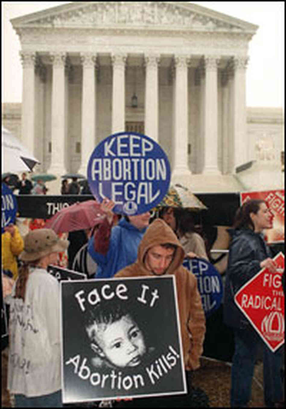 Abortion Protest Abortion Protest