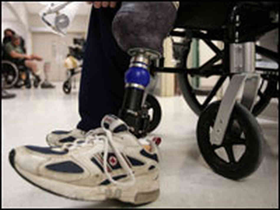 An amputee waits in the fitting clinic of Walter Reed Army Medical Center. An amputee waits in the fitting clinic of Walter Reed Army Medical Center.