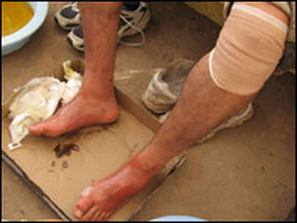 An immigrant gets his swollen feet washed An immigrant gets his swollen feet washed