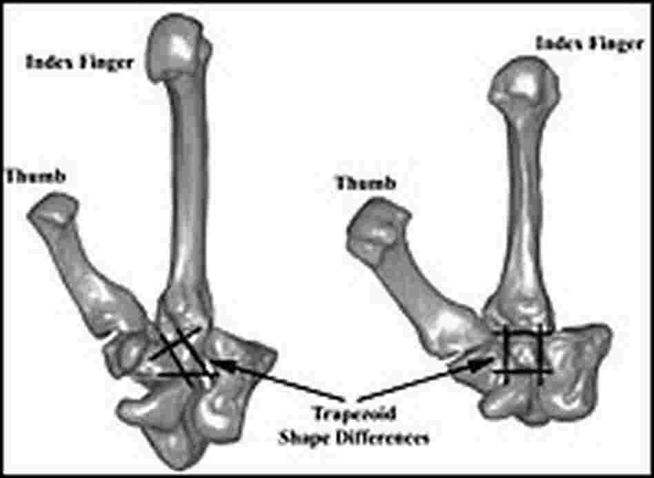 Bone comparison