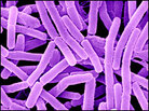A microscopic look at anthrax bacteria. A microscopic look at anthrax bacteria.