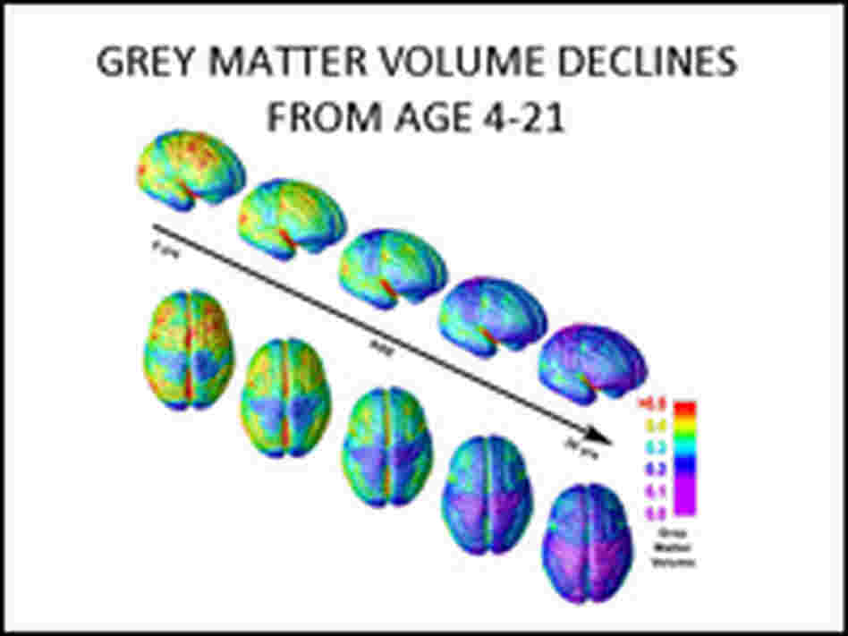A chart showing how volume of gray matter declines with age.