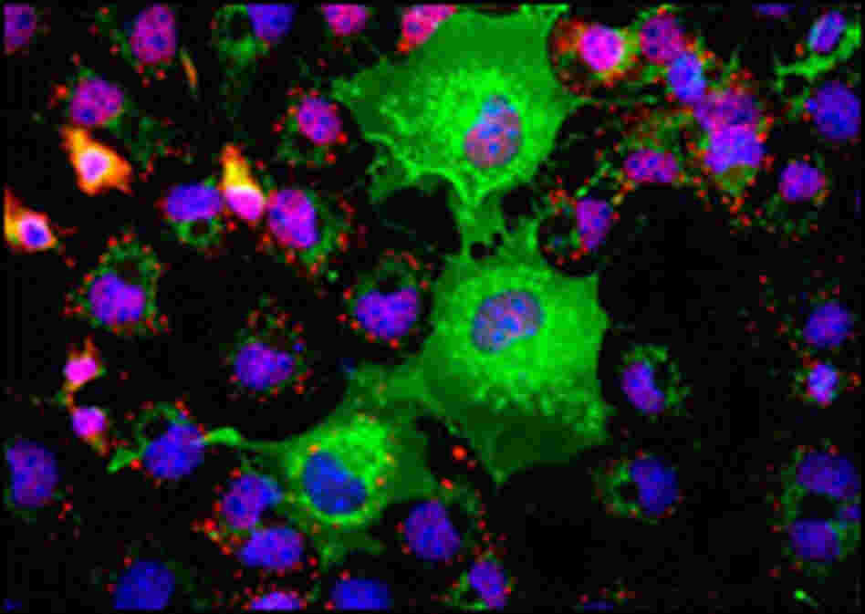 Cancer cells tagged with fluorescent markers Cancer cells tagged with fluorescent markers