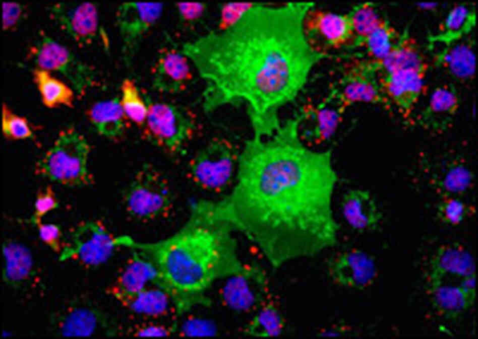 Cancer cells tagged with fluorescent markers Cancer cells tagged with fluorescent markers