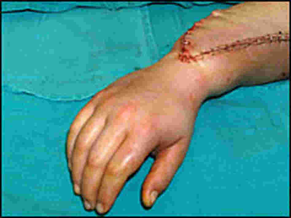 Savage's new hand.