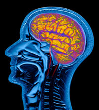 An MRI scan of a man's brain. Richard Restak says research shows that the brain responds to stretching and challenging exercises in every stage of life.