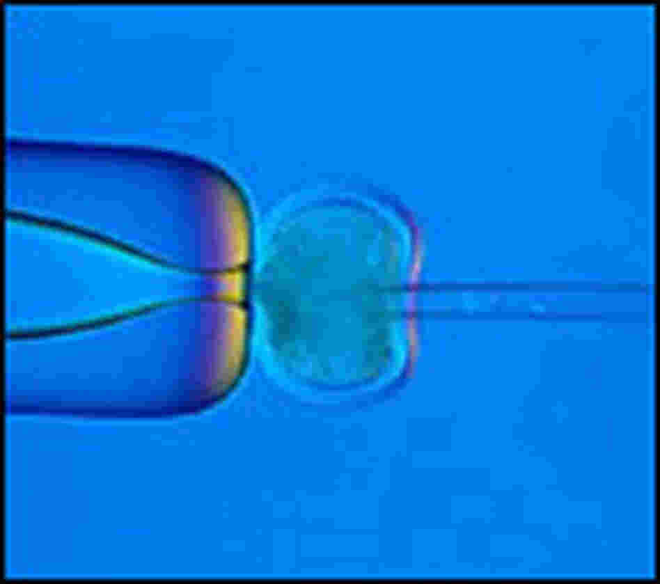 A nucleus is removed from a cell. A nucleus is removed from a cell.