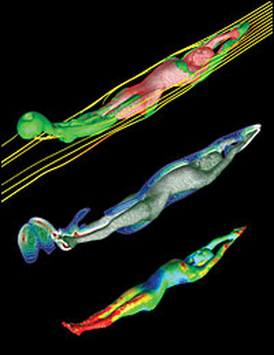 Swimmer plots