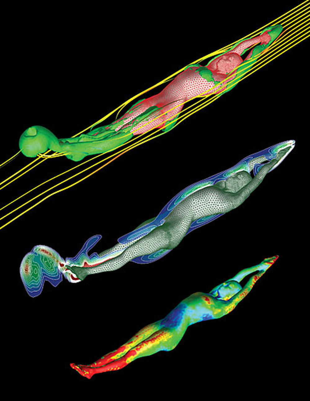 Swimmer plots