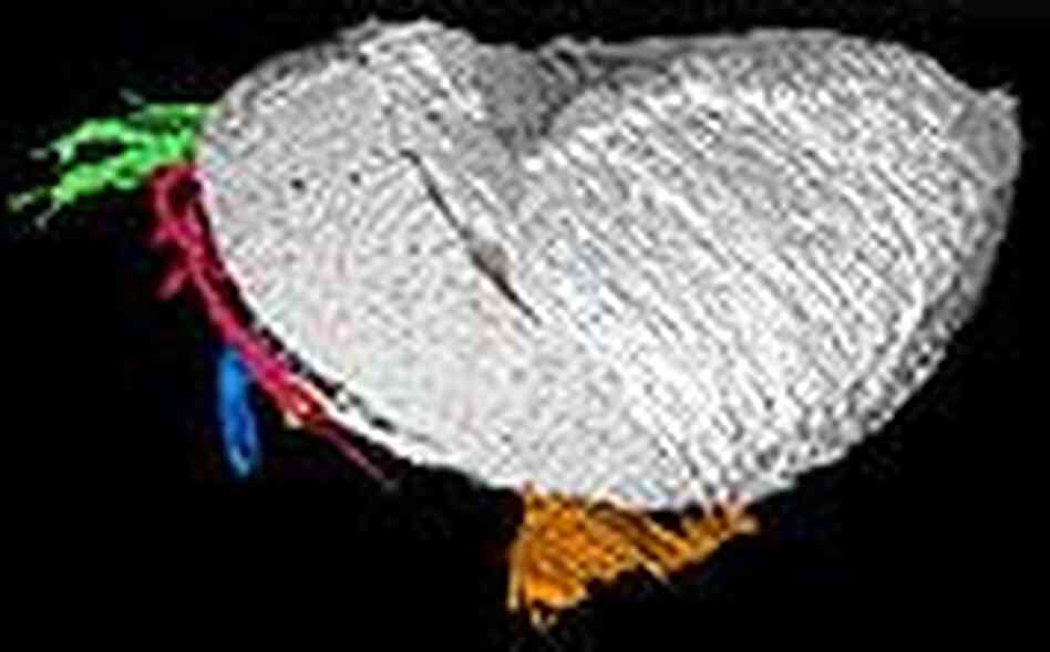 A computer representation of a 425-million-year-old water flea fossil. A computer representation of a 425-million-year-old water flea fossil.