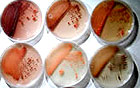 petri dishes hold marine microbes