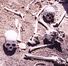 Bones in shallow grave in Sierra Leone
