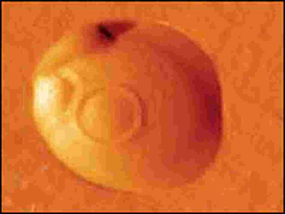 Close-up of an atomic force microscope image of a yeast cell. Close-up of an atomic force microscope image of a yeast cell.