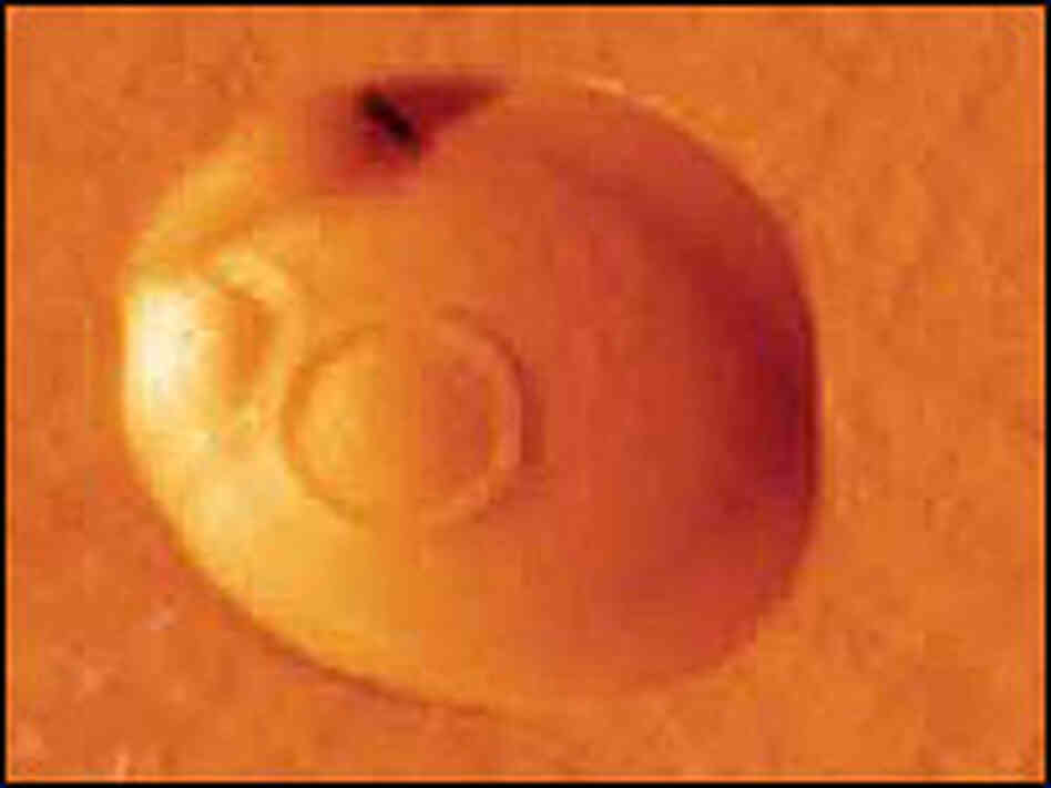Close-up of an atomic force microscope image of a yeast cell. Close-up of an atomic force microscope image of a yeast cell.