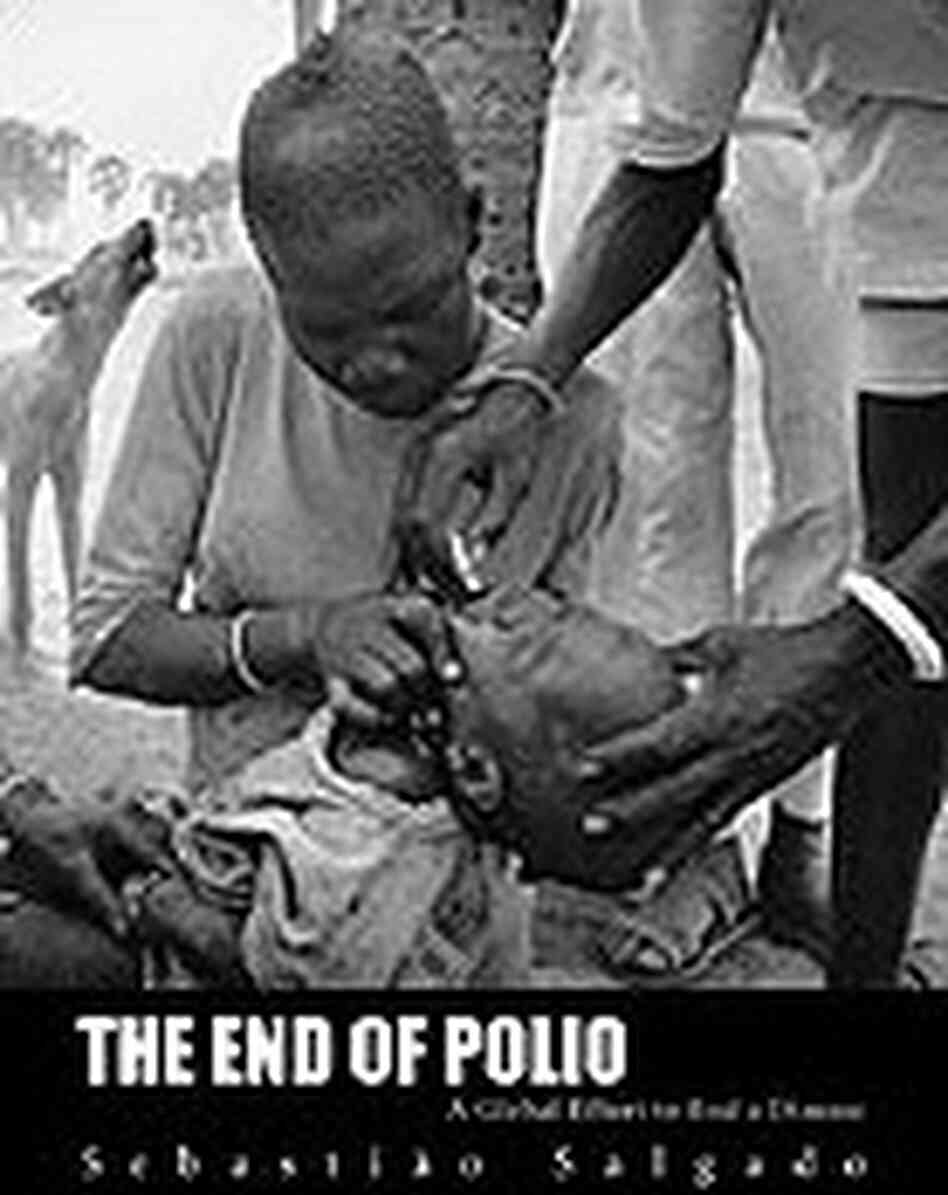 The End of Polio: A Global Effort to End a Disease, by Sebastiao Salgado The End of Polio: A Global Effort to End a Disease, by Sebastiao Salgado