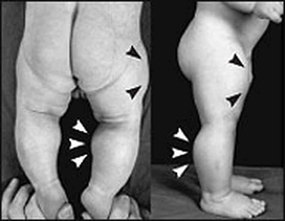 Images of the child at six days and seven months. Images of the child at six days and seven months.