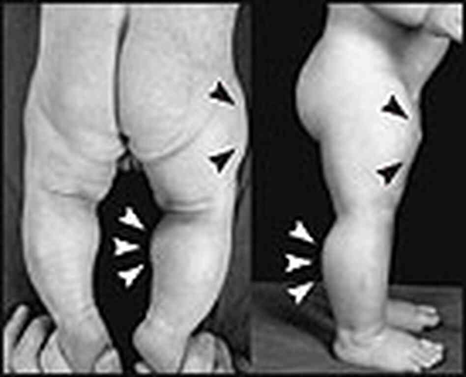 Images of the child at six days and seven months. Images of the child at six days and seven months.