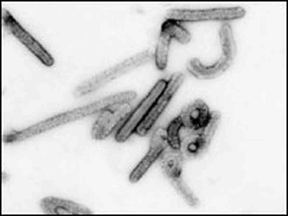 Marburg virus under the microscope. Marburg virus under the microscope.