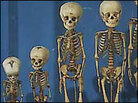 Museum specimens illustrate childhood skeletal growth Museum specimens illustrate childhood skeletal growth