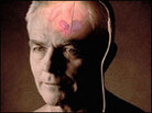 deep brain stimulation image deep brain stimulation image