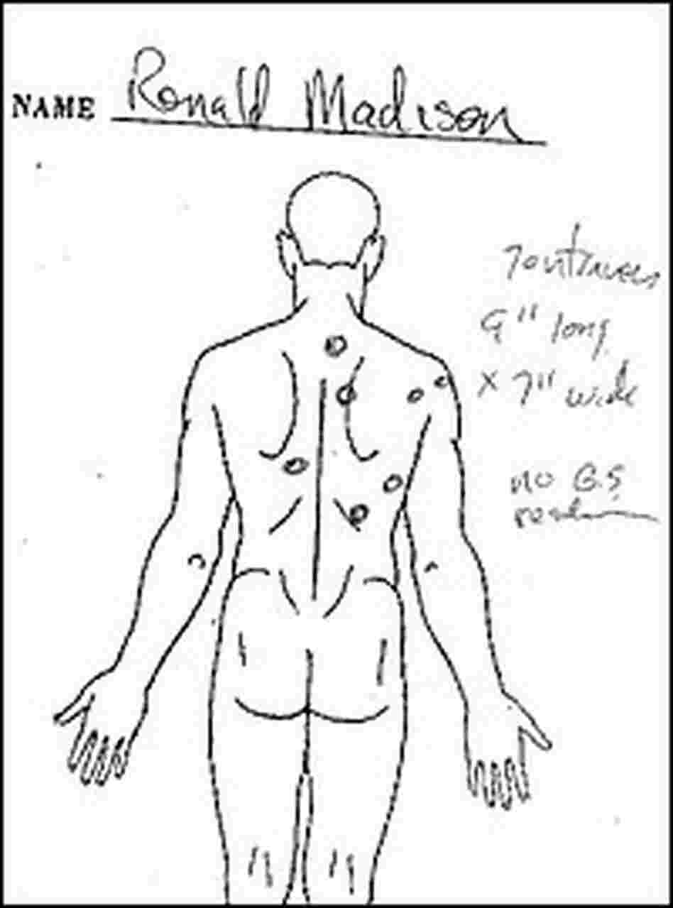 The Madison family lawyer requested a second autopsy of Ronald Madison.