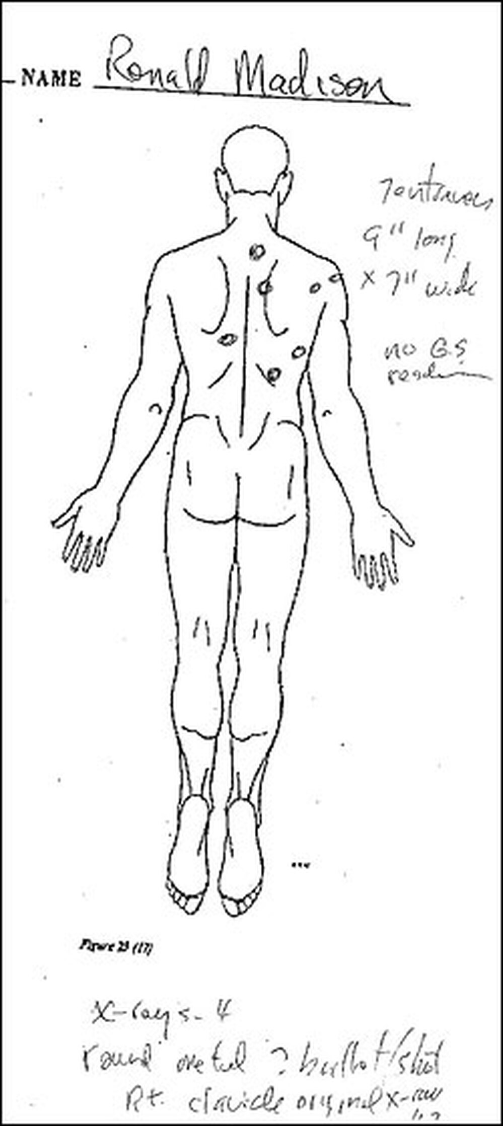 The Madison family lawyer requested a second autopsy of Ronald Madison.