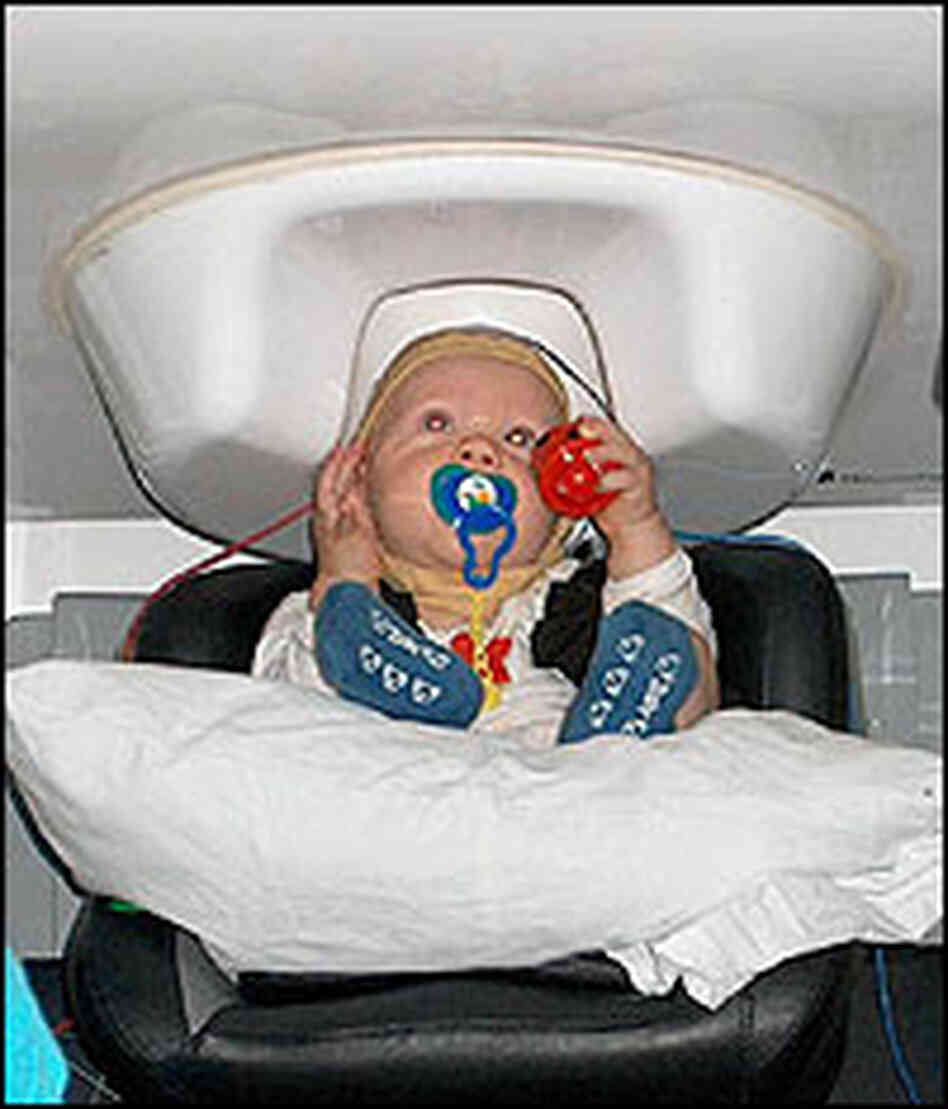 A baby's head rests inside an M.E.G. -- a machine that tracks brain cell activity. A baby's head rests inside an M.E.G. -- a machine that tracks brain cell activity.