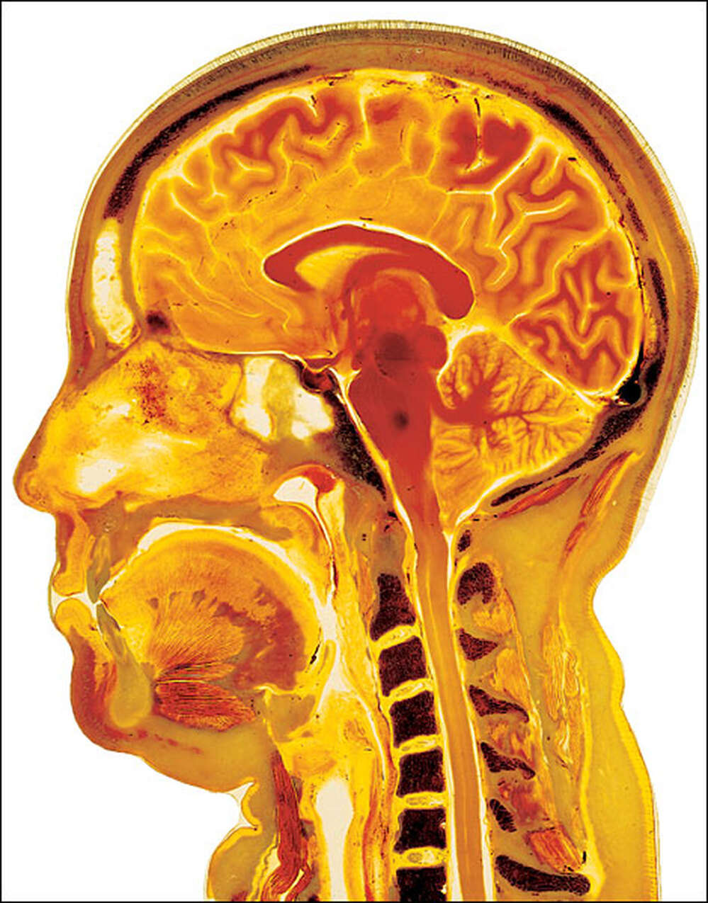 Head slice