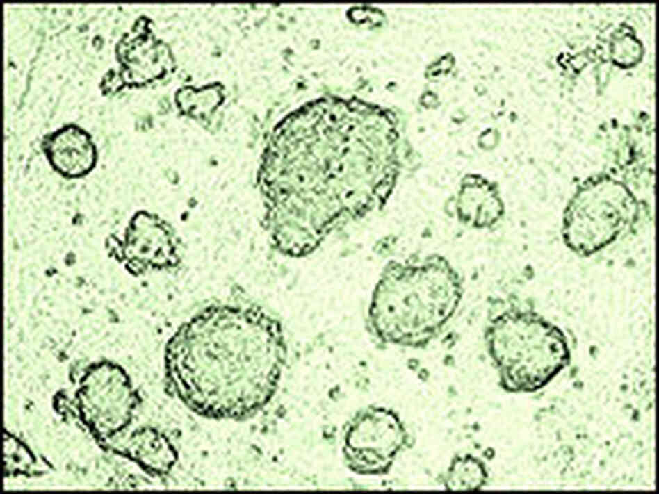 Image of stem cells under a microscope. Image of stem cells under a microscope.