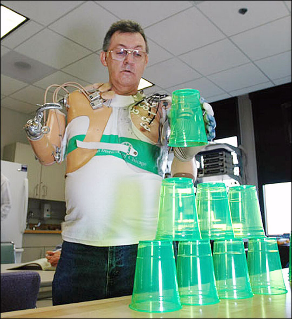 Jesse Sullivan demonstrates capabilites of prototype arm