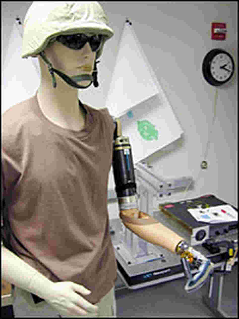 Prototype 1 prosthetic arm Prototype 1 prosthetic arm