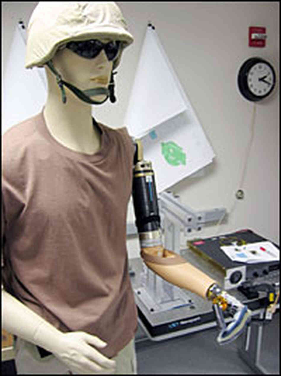 Prototype 1 prosthetic arm Prototype 1 prosthetic arm