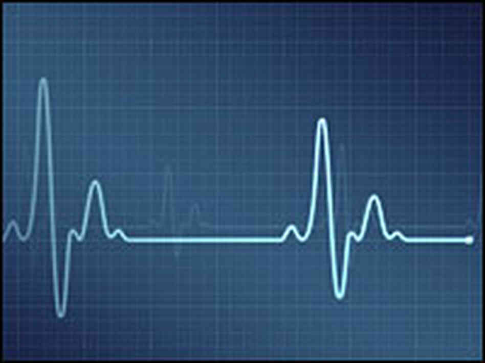 An electrocardiogram, one of the tools used to diagnose heart health. An electrocardiogram, one of the tools used to diagnose heart health.