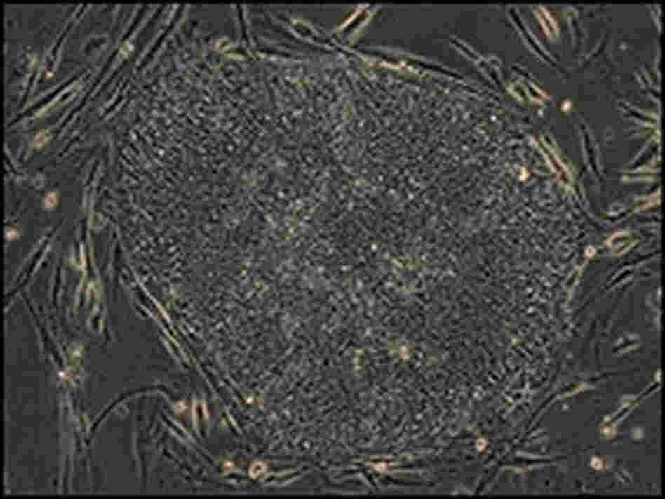 Genetic modifications in skin cells. Genetic modifications in skin cells.