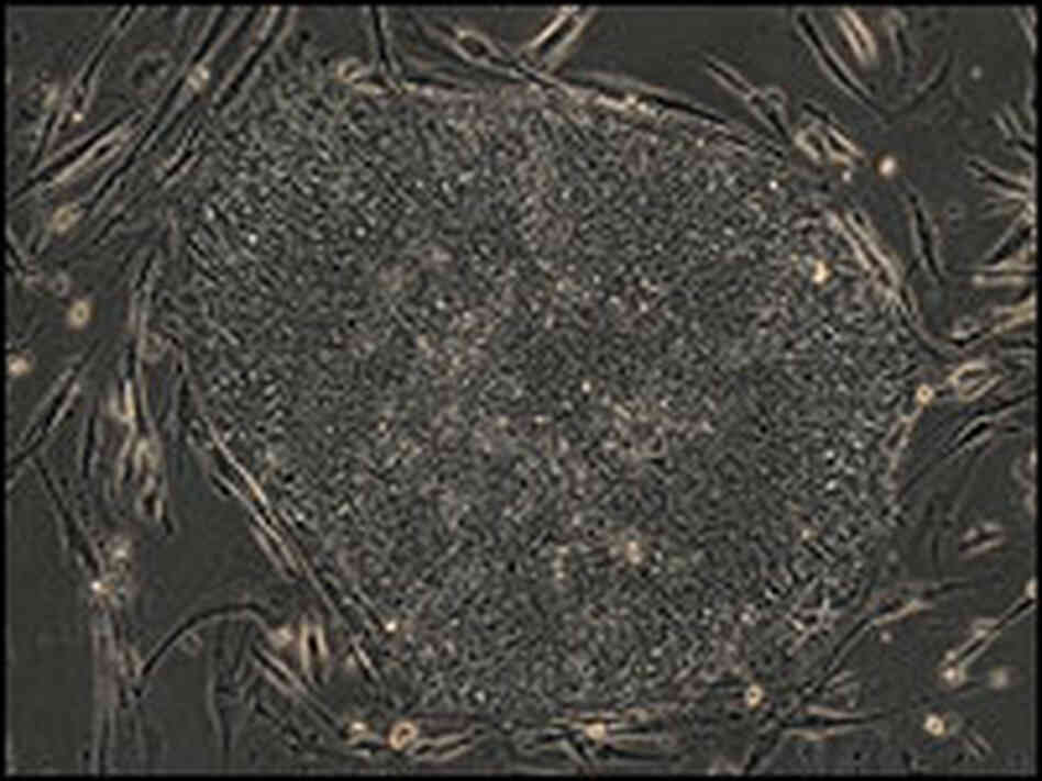Genetic modifications in skin cells. Genetic modifications in skin cells.