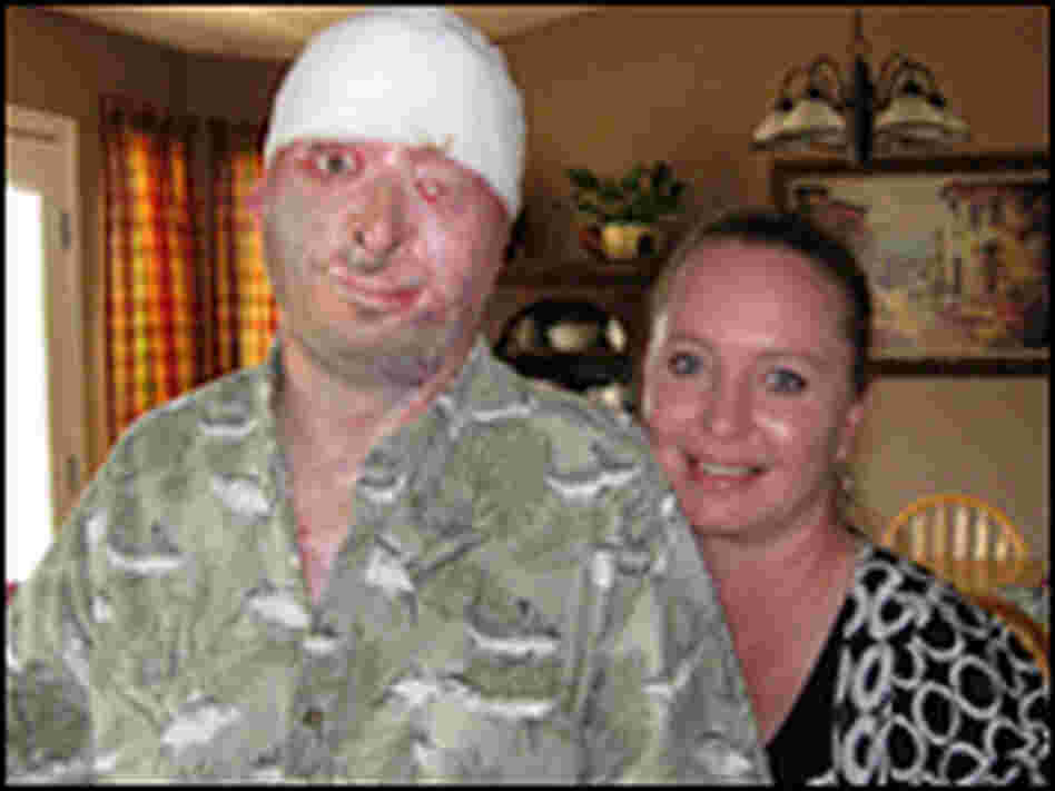 Robert Henline and his wife, Connie, at home in San Antonio.