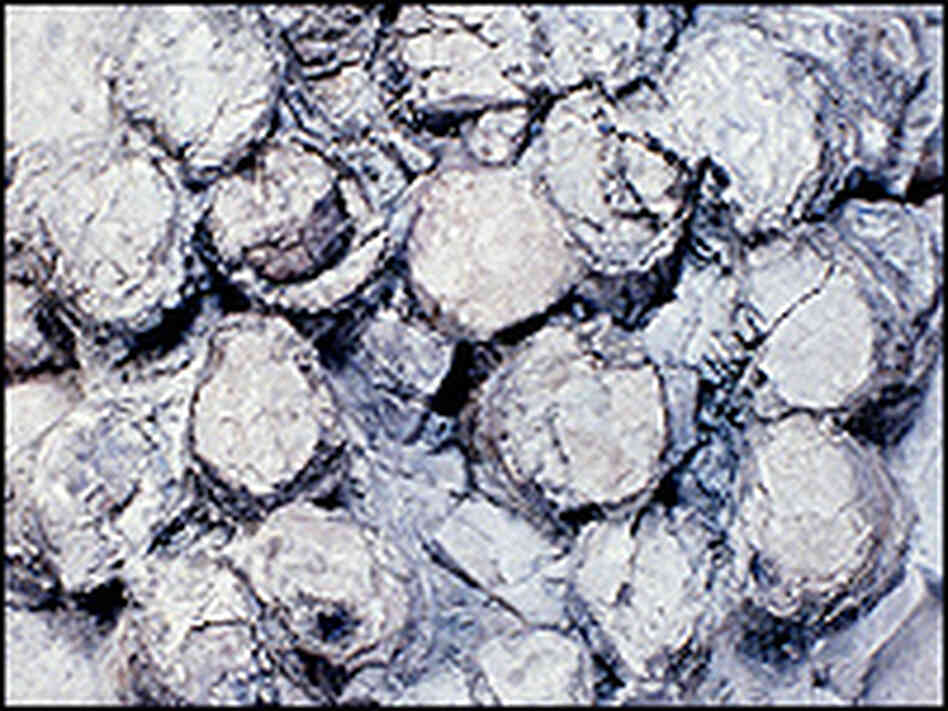 Top view of Troodon egg clutch consisting of 24 large eggs. Top view of Troodon egg clutch consisting of 24 large eggs.