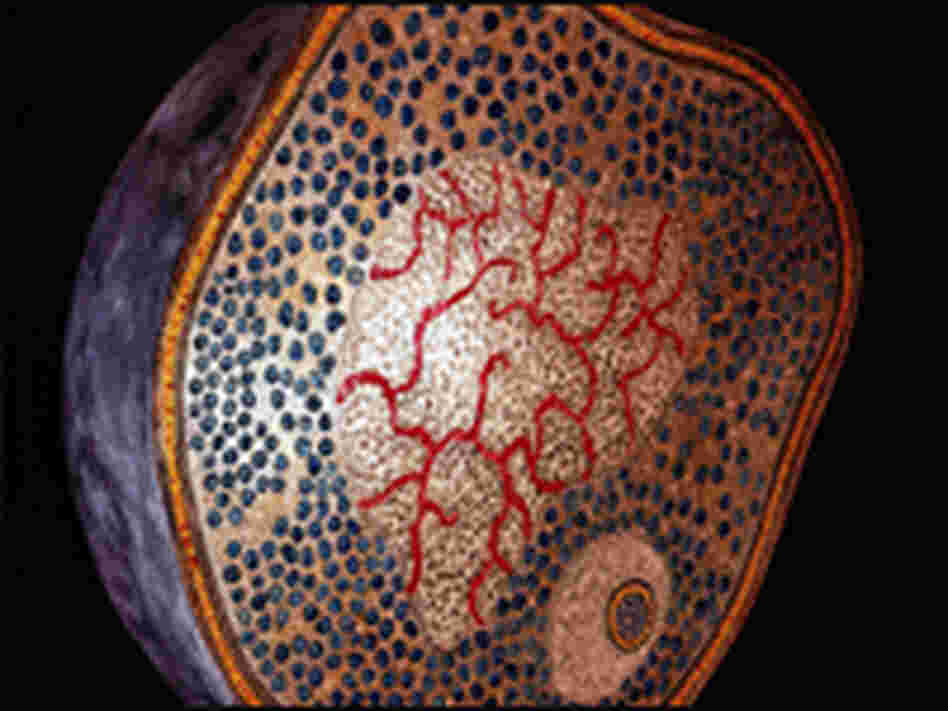 Artist's conception of mycoplasma bacterium.