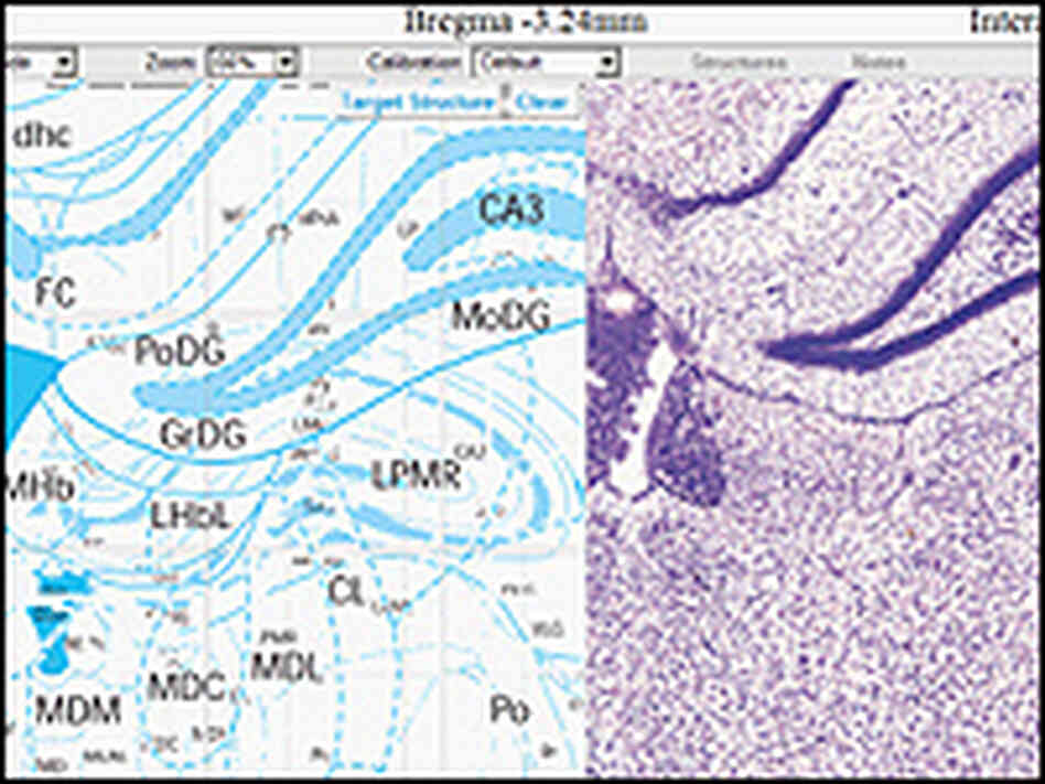A brain map next to a photo of a brain tissue sample. A brain map next to a photo of a brain tissue sample.
