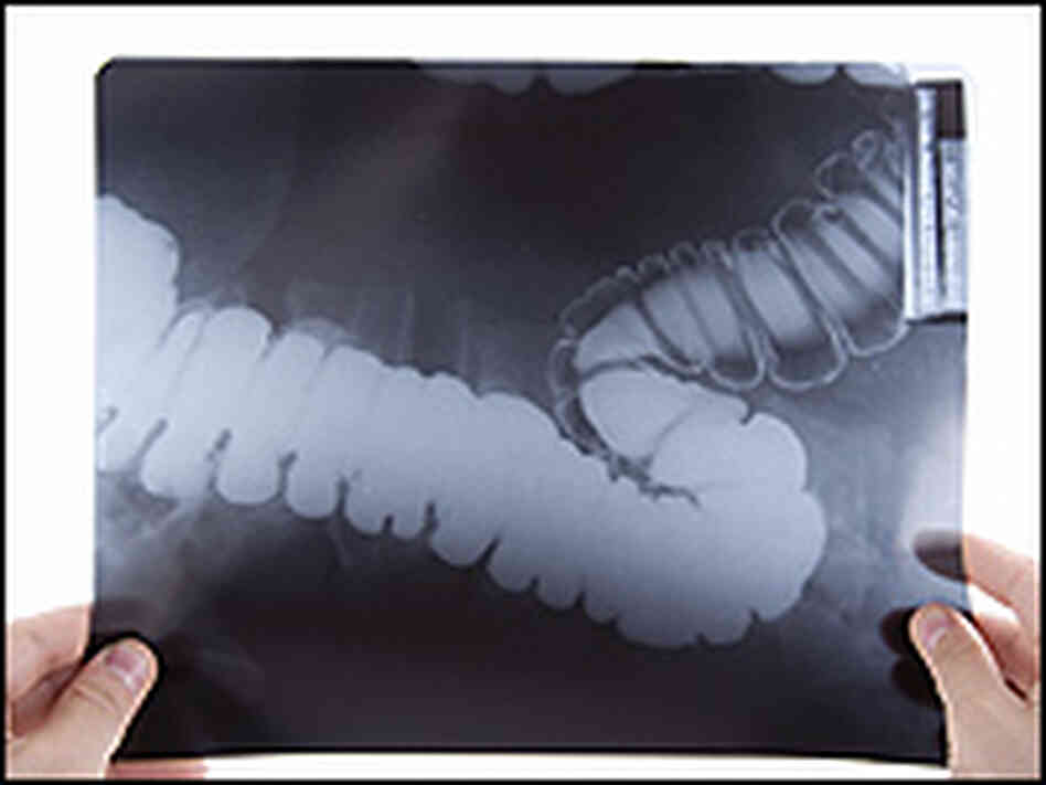 A doctor holds up an X-ray of the large intestine. A doctor holds up an X-ray of the large intestine.
