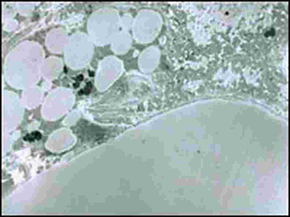 White and brown fat cells