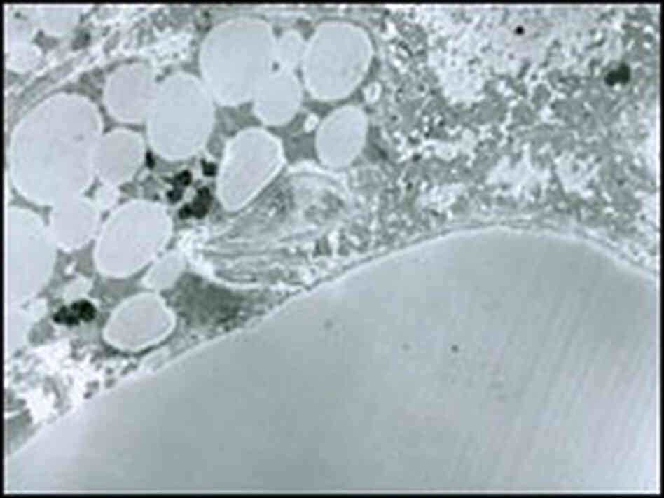 White and brown fat cells