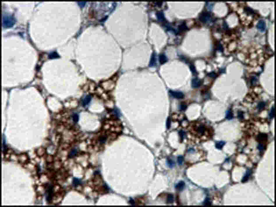 Tissue showing brown and white fat cells